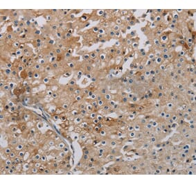 Immunohistochemistry - PHKA2 Antibody from Signalway Antibody (37823) - Antibodies.com