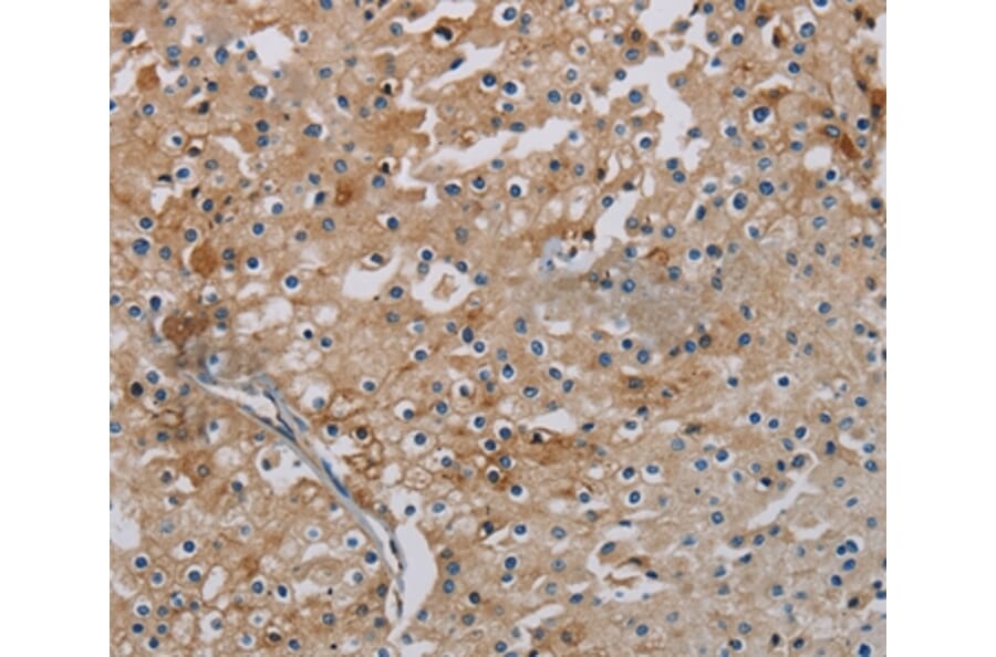 Immunohistochemistry - PHKA2 Antibody from Signalway Antibody (37823) - Antibodies.com