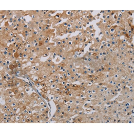 Immunohistochemistry - PHKA2 Antibody from Signalway Antibody (37823) - Antibodies.com