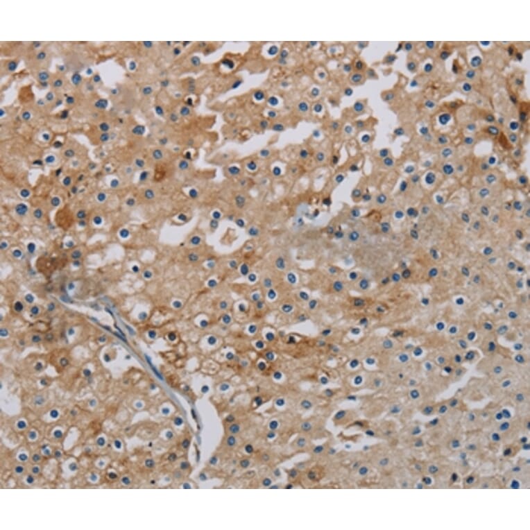 Immunohistochemistry - PHKA2 Antibody from Signalway Antibody (37823) - Antibodies.com