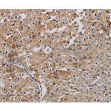 Immunohistochemistry - PHKA2 Antibody from Signalway Antibody (37823) - Antibodies.com
