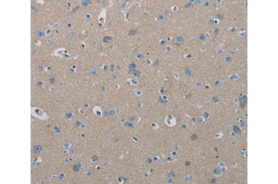 Immunohistochemistry - PHKA2 Antibody from Signalway Antibody (37823) - Antibodies.com