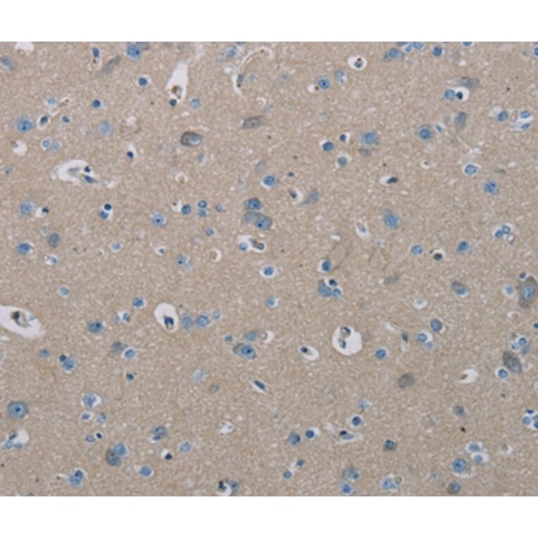 Immunohistochemistry - PHKA2 Antibody from Signalway Antibody (37823) - Antibodies.com