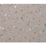 Immunohistochemistry - PHKA2 Antibody from Signalway Antibody (37823) - Antibodies.com