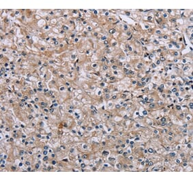 Immunohistochemistry - PLCL1 Antibody from Signalway Antibody (37831) - Antibodies.com