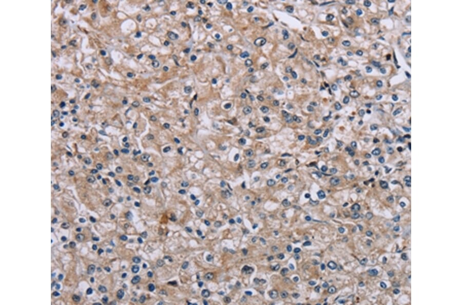 Immunohistochemistry - PLCL1 Antibody from Signalway Antibody (37831) - Antibodies.com