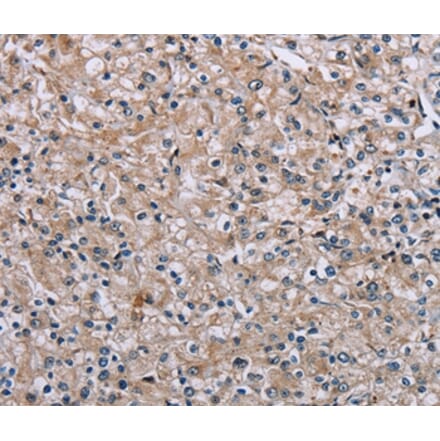 Immunohistochemistry - PLCL1 Antibody from Signalway Antibody (37831) - Antibodies.com