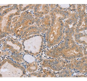 Immunohistochemistry - PTPN4 Antibody from Signalway Antibody (37851) - Antibodies.com