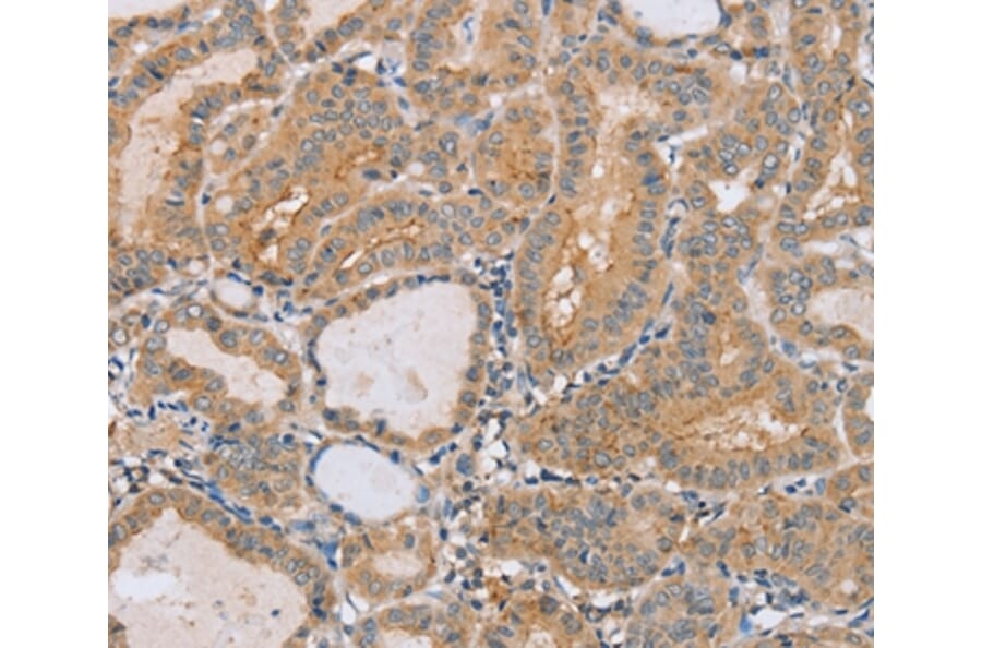 Immunohistochemistry - PTPN4 Antibody from Signalway Antibody (37851) - Antibodies.com