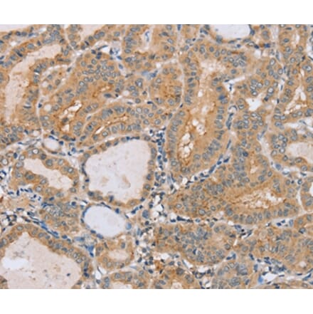 Immunohistochemistry - PTPN4 Antibody from Signalway Antibody (37851) - Antibodies.com