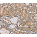 Immunohistochemistry - PTPN4 Antibody from Signalway Antibody (37851) - Antibodies.com