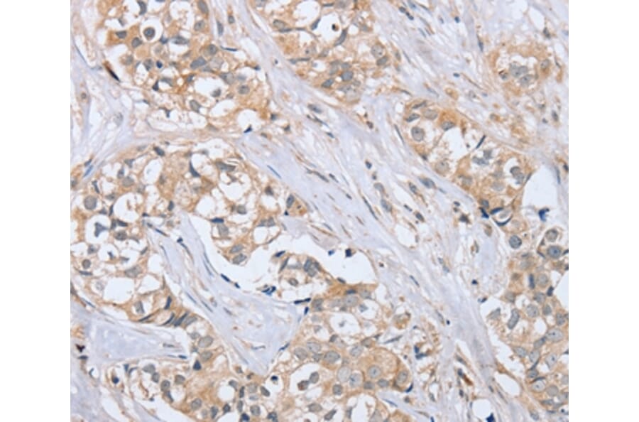 Immunohistochemistry - PTPN4 Antibody from Signalway Antibody (37851) - Antibodies.com