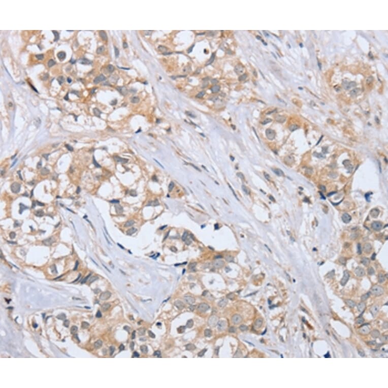 Immunohistochemistry - PTPN4 Antibody from Signalway Antibody (37851) - Antibodies.com