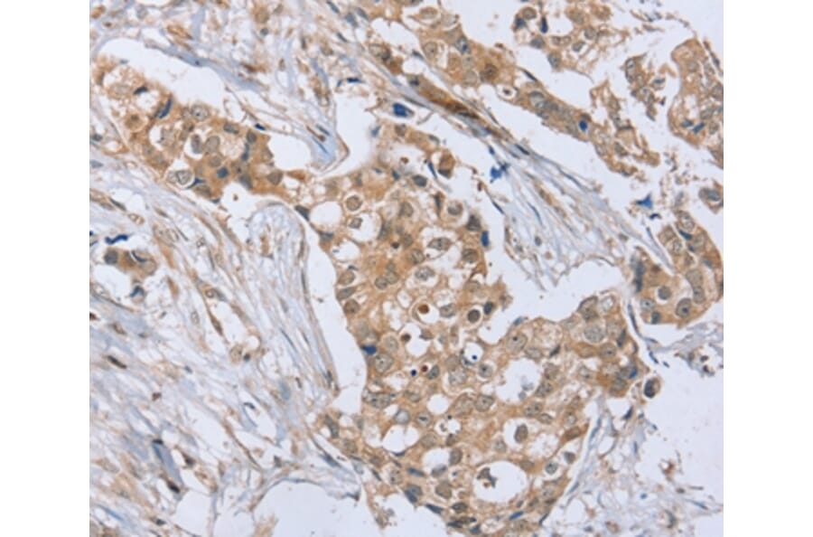Immunohistochemistry - RAB8B Antibody from Signalway Antibody (37853) - Antibodies.com