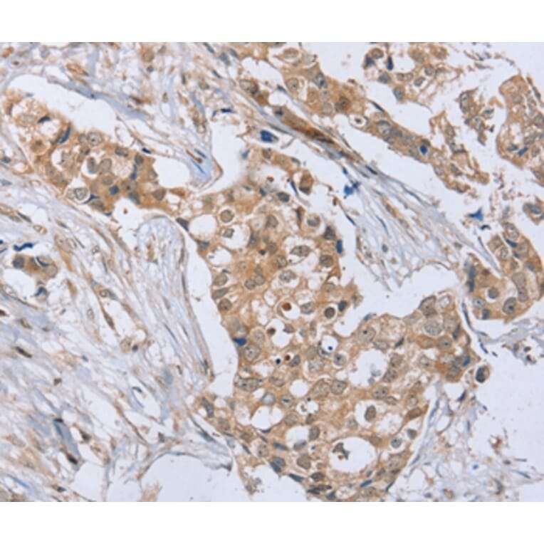 Immunohistochemistry - RAB8B Antibody from Signalway Antibody (37853) - Antibodies.com