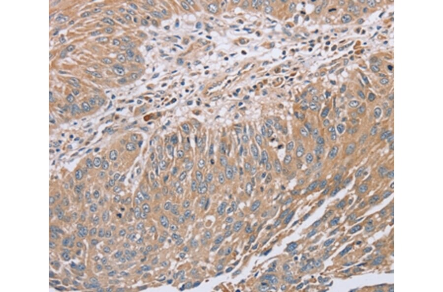 Immunohistochemistry - RAB8B Antibody from Signalway Antibody (37853) - Antibodies.com