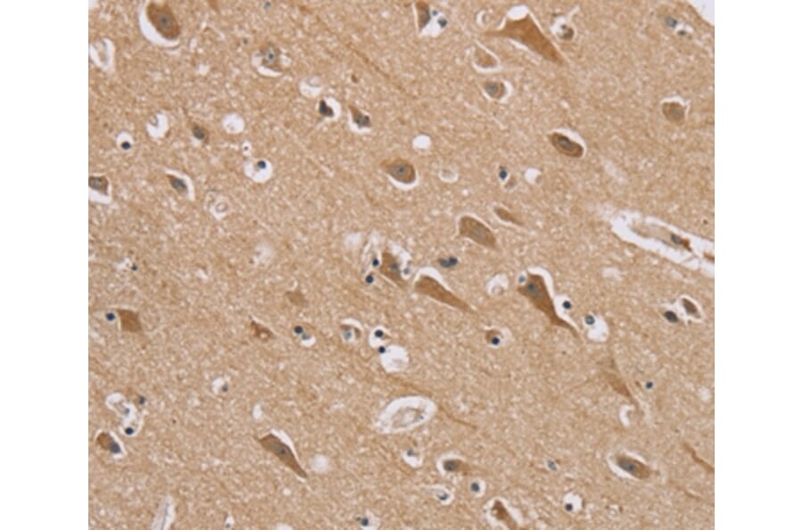 Immunohistochemistry - RAB6C Antibody from Signalway Antibody (37855) - Antibodies.com