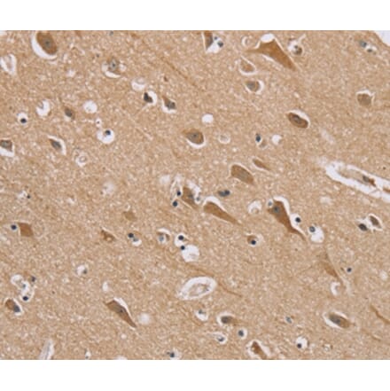 Immunohistochemistry - RAB6C Antibody from Signalway Antibody (37855) - Antibodies.com