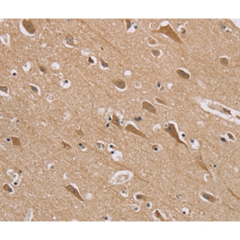 Immunohistochemistry - RAB6C Antibody from Signalway Antibody (37855) - Antibodies.com