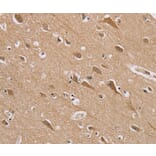 Immunohistochemistry - RAB6C Antibody from Signalway Antibody (37855) - Antibodies.com