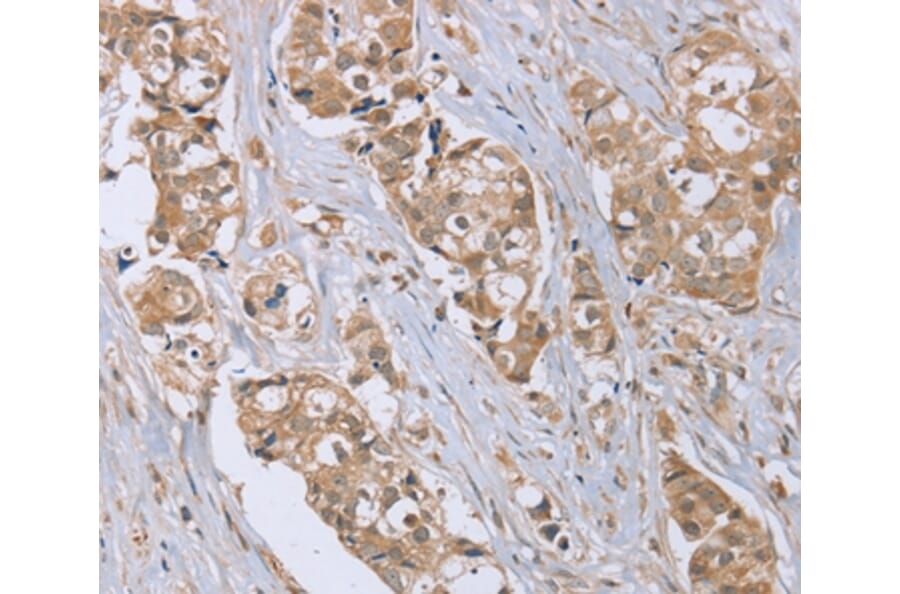 Immunohistochemistry - RAB6C Antibody from Signalway Antibody (37855) - Antibodies.com