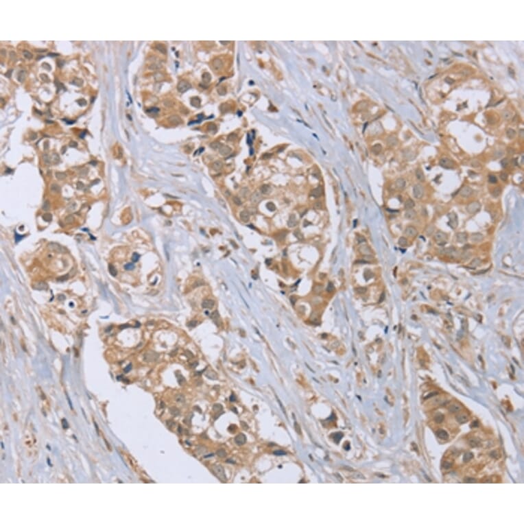 Immunohistochemistry - RAB6C Antibody from Signalway Antibody (37855) - Antibodies.com