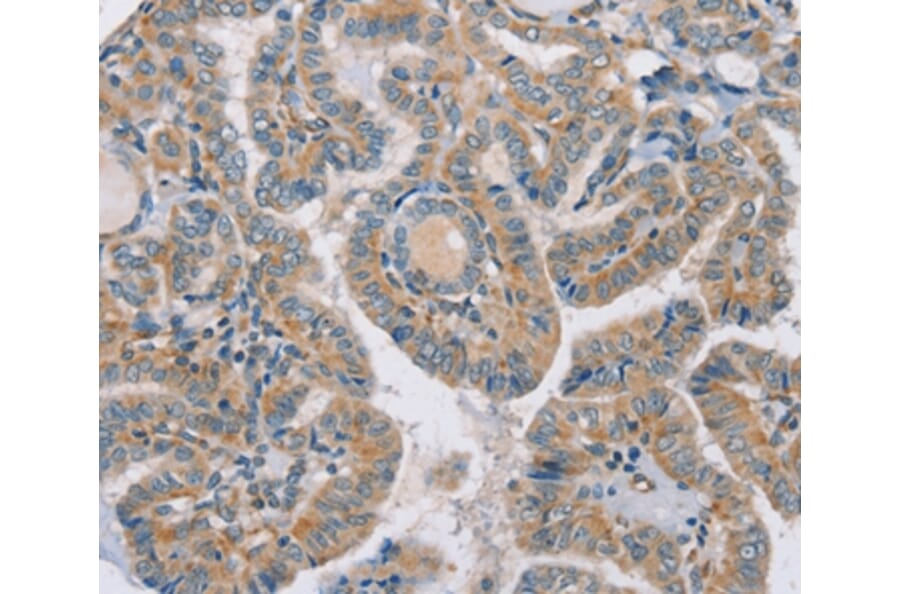 Immunohistochemistry - RAB21 Antibody from Signalway Antibody (37858) - Antibodies.com