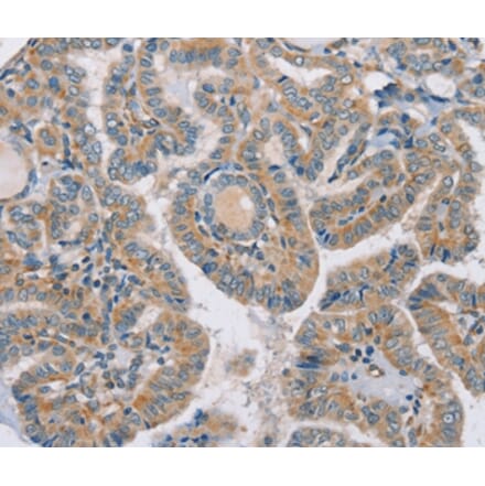 Immunohistochemistry - RAB21 Antibody from Signalway Antibody (37858) - Antibodies.com