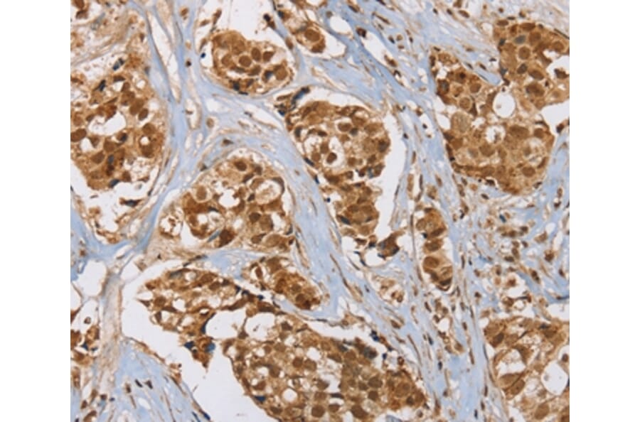 Immunohistochemistry - RAB24 Antibody from Signalway Antibody (37859) - Antibodies.com