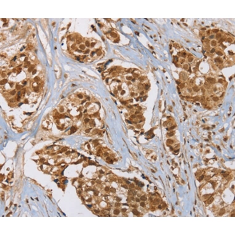 Immunohistochemistry - RAB24 Antibody from Signalway Antibody (37859) - Antibodies.com