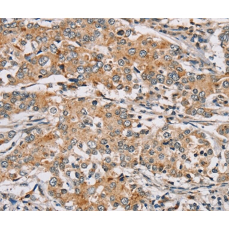 Immunohistochemistry - RAB24 Antibody from Signalway Antibody (37859) - Antibodies.com