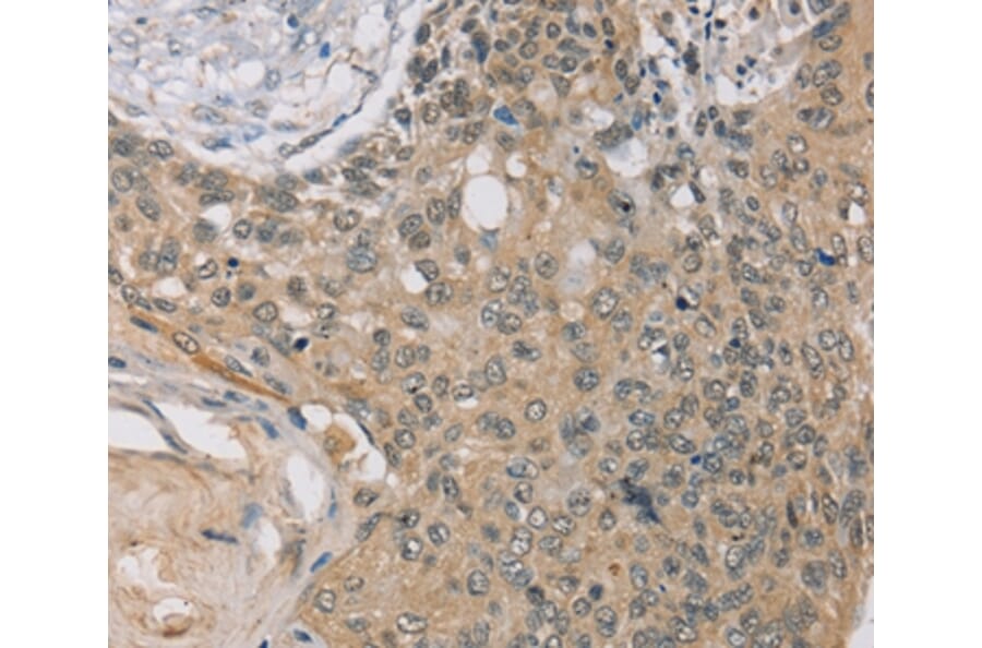 Immunohistochemistry - RASA2 Antibody from Signalway Antibody (37861) - Antibodies.com