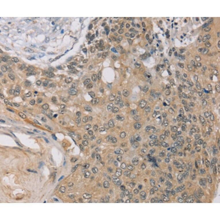 Immunohistochemistry - RASA2 Antibody from Signalway Antibody (37861) - Antibodies.com