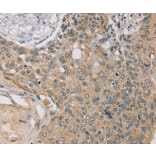 Immunohistochemistry - RASA2 Antibody from Signalway Antibody (37861) - Antibodies.com