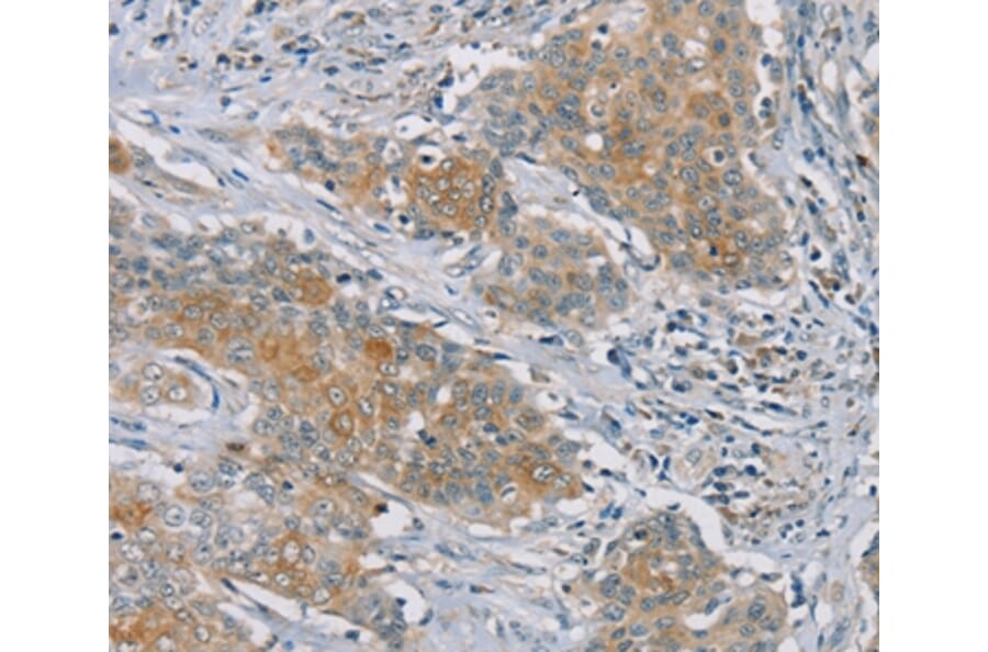 Immunohistochemistry - RASA2 Antibody from Signalway Antibody (37861) - Antibodies.com