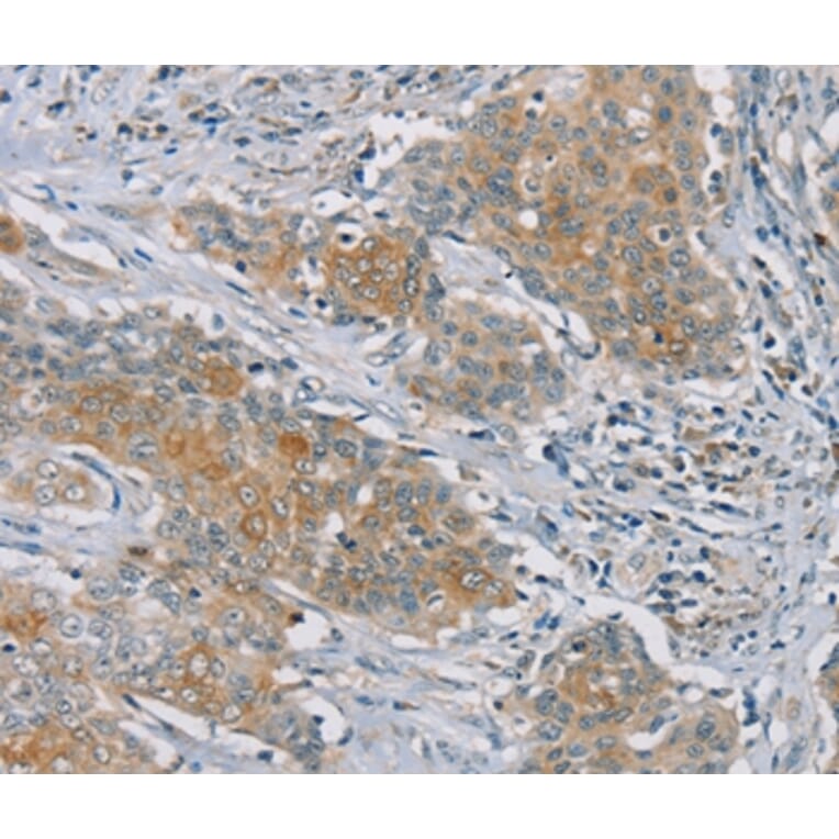 Immunohistochemistry - RASA2 Antibody from Signalway Antibody (37861) - Antibodies.com