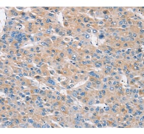 Immunohistochemistry - RASA3 Antibody from Signalway Antibody (37862) - Antibodies.com