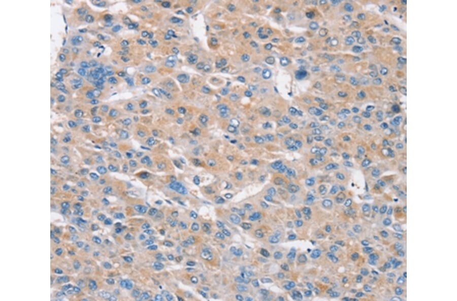 Immunohistochemistry - RASA3 Antibody from Signalway Antibody (37862) - Antibodies.com