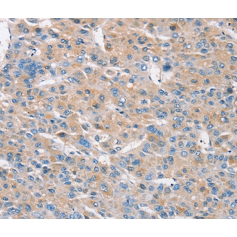 Immunohistochemistry - RASA3 Antibody from Signalway Antibody (37862) - Antibodies.com