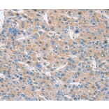 Immunohistochemistry - RASA3 Antibody from Signalway Antibody (37862) - Antibodies.com