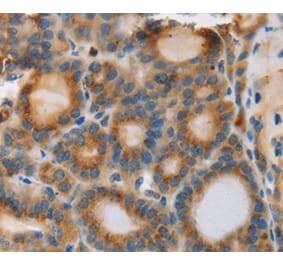 Immunohistochemistry - RIPK4 Antibody from Signalway Antibody (37870) - Antibodies.com