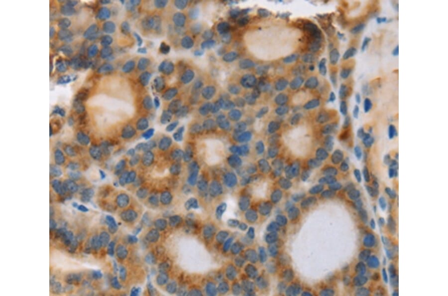 Immunohistochemistry - RIPK4 Antibody from Signalway Antibody (37870) - Antibodies.com
