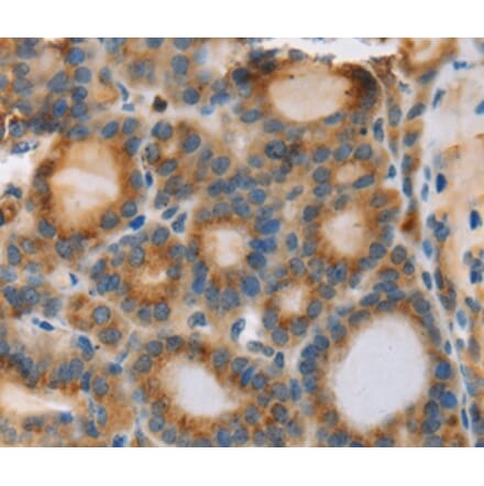 Immunohistochemistry - RIPK4 Antibody from Signalway Antibody (37870) - Antibodies.com