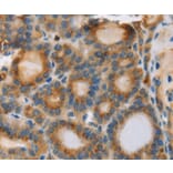 Immunohistochemistry - RIPK4 Antibody from Signalway Antibody (37870) - Antibodies.com