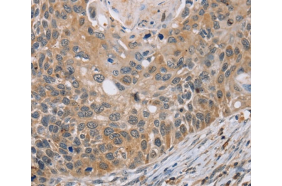 Immunohistochemistry - RIPK4 Antibody from Signalway Antibody (37870) - Antibodies.com