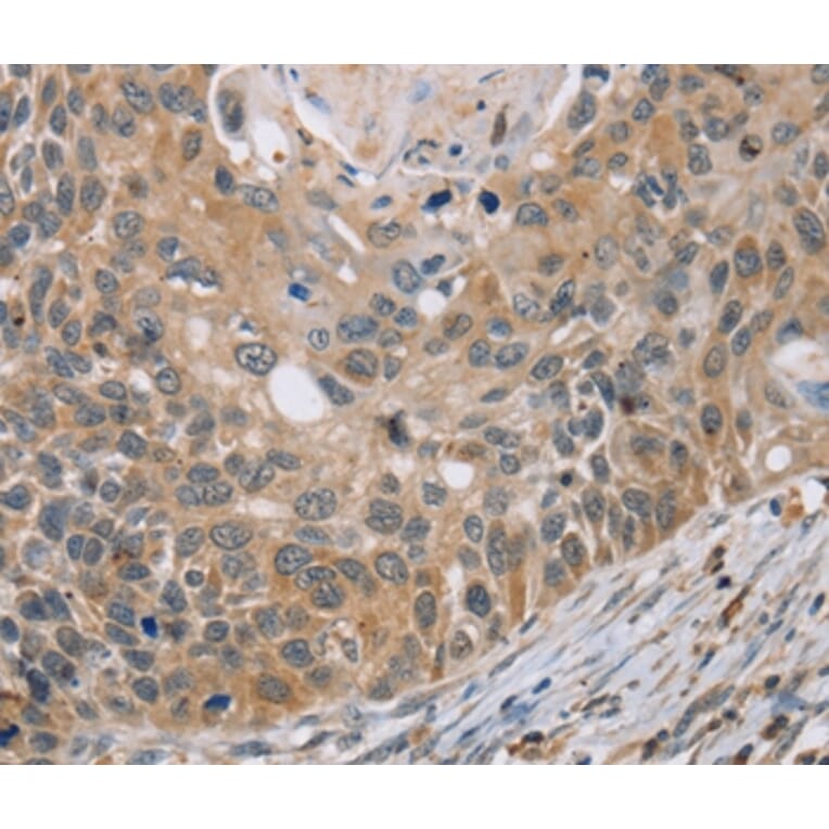 Immunohistochemistry - RIPK4 Antibody from Signalway Antibody (37870) - Antibodies.com