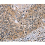 Immunohistochemistry - RIPK4 Antibody from Signalway Antibody (37870) - Antibodies.com