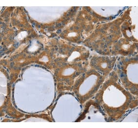 Immunohistochemistry - TRIM3 Antibody from Signalway Antibody (37876) - Antibodies.com