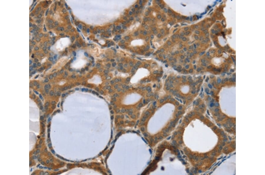 Immunohistochemistry - TRIM3 Antibody from Signalway Antibody (37876) - Antibodies.com