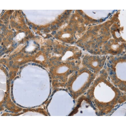 Immunohistochemistry - TRIM3 Antibody from Signalway Antibody (37876) - Antibodies.com